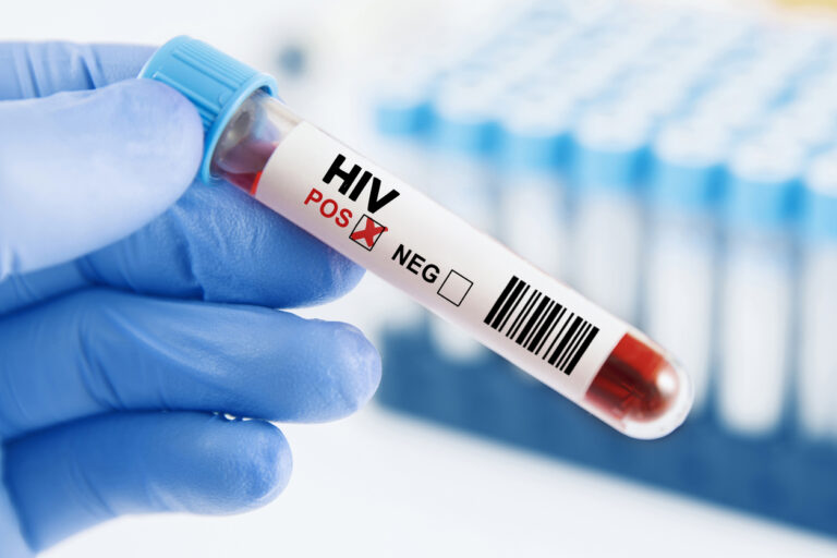 HIV/AIDS: Πάνω από τις μισές διαγνώσεις στην Ελλάδα γίνονται καθυστερημένα - Δράσεις ελέγχου από τον ΕΟΔΥ
