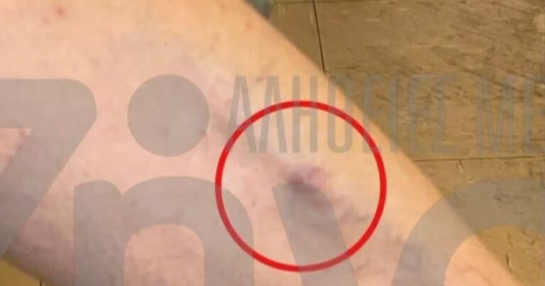 Θριάσιο: 38χρονος ασθενής καταγγέλλει ότι ξυλοκοπήθηκε συνοδό άλλου ασθενούς μέσα στον θάλαμο νοσηλείας